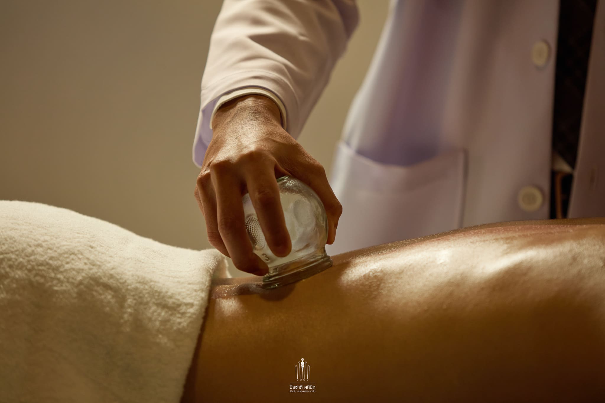 Cupping therapy รักษาโรคโดยแพทย์แผนจีน