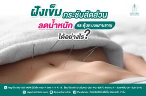การฝังเข็มกระชับสัดส่วนช่วยกระตุ้นระบบเผาผลาญได้อย่างไร