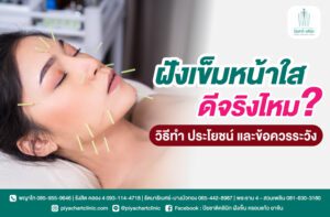 ฝังเข็มหน้าใสดีจริงไหมวิธีทำ ประโยชน์ และข้อควรระวัง