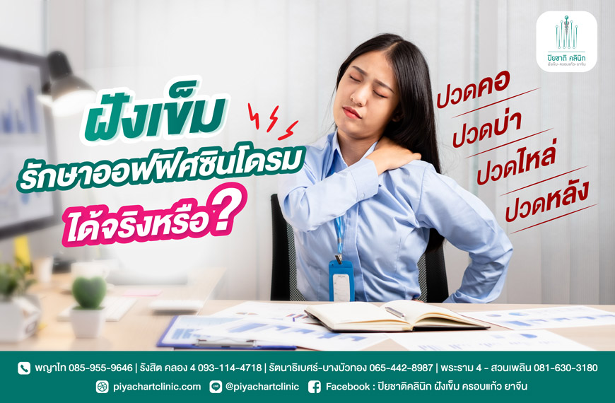 ฝังเข็มช่วยรักษาออฟฟิศซินโดรมได้จริงหรือแค่ความเชื่อ