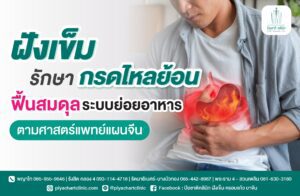 ฝังเข็มรักษากรดไหลย้อน ฟื้นสมดุลระบบย่อยอาหารตามศาสตร์แพทย์แผนจีน