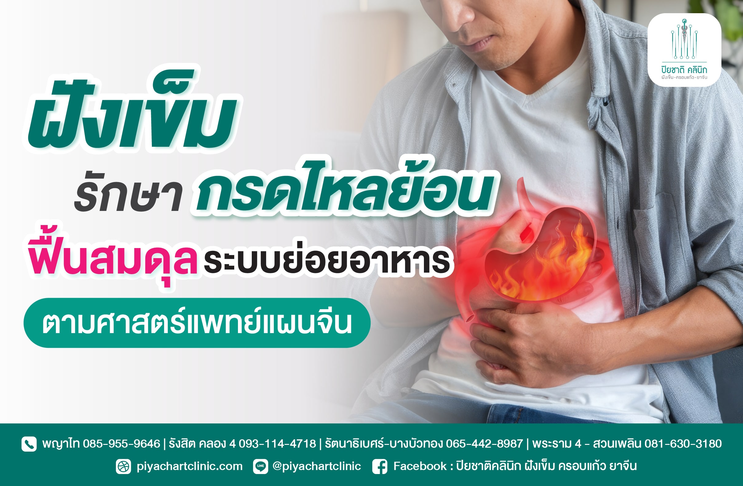 ฝังเข็มรักษากรดไหลย้อน ฟื้นสมดุลระบบย่อยอาหารตามศาสตร์แพทย์แผนจีน