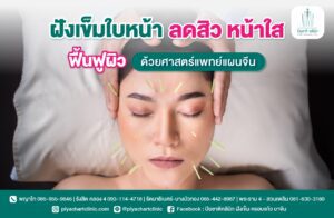 ฝังเข็มใบหน้า ลดสิว หน้าใส ฟื้นฟูผิวด้วยศาสตร์แพทย์แผนจีน