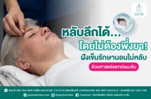หลับลึกได้...โดยไม่ต้องพึ่งยา! ฝังเข็มรักษานอนไม่หลับด้วยศาสตร์แพทย์แผนจีน