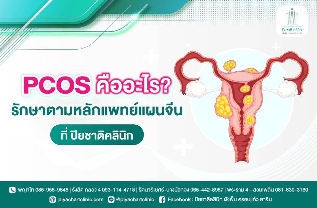 PCOS คืออะไร? รักษาตามหลักแพทย์แผนจีนที่ปิยชาติคลินิก