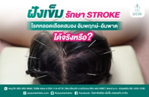 ฝังเข็มรักษา STROKE โรคหลอดเลือดสมอง อัมพฤกษ์-อัมพาตได้จริงหรือ ?