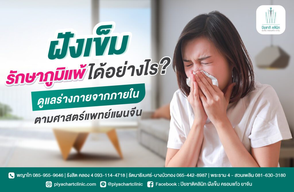 ฝังเข็มรักษาภูมิแพ้ได้อย่างไร? ดูแลร่างกายจากภายในตามศาสตร์แพทย์แผนจีน