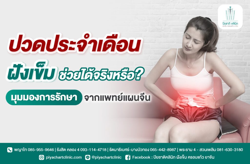 ปวดประจำเดือน ฝังเข็มช่วยได้จริงหรือ? มุมมองการรักษาจากแพทย์แผนจีน