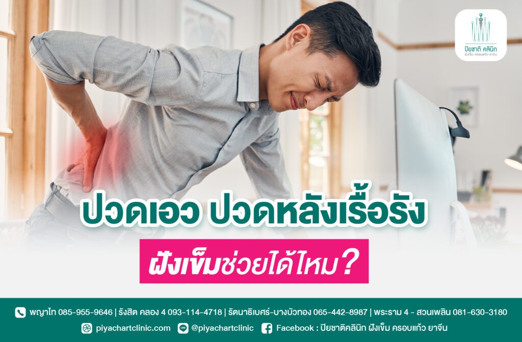 ปวดเอว ปวดหลังเรื้อรัง ฝังเข็มช่วยได้ไหม?