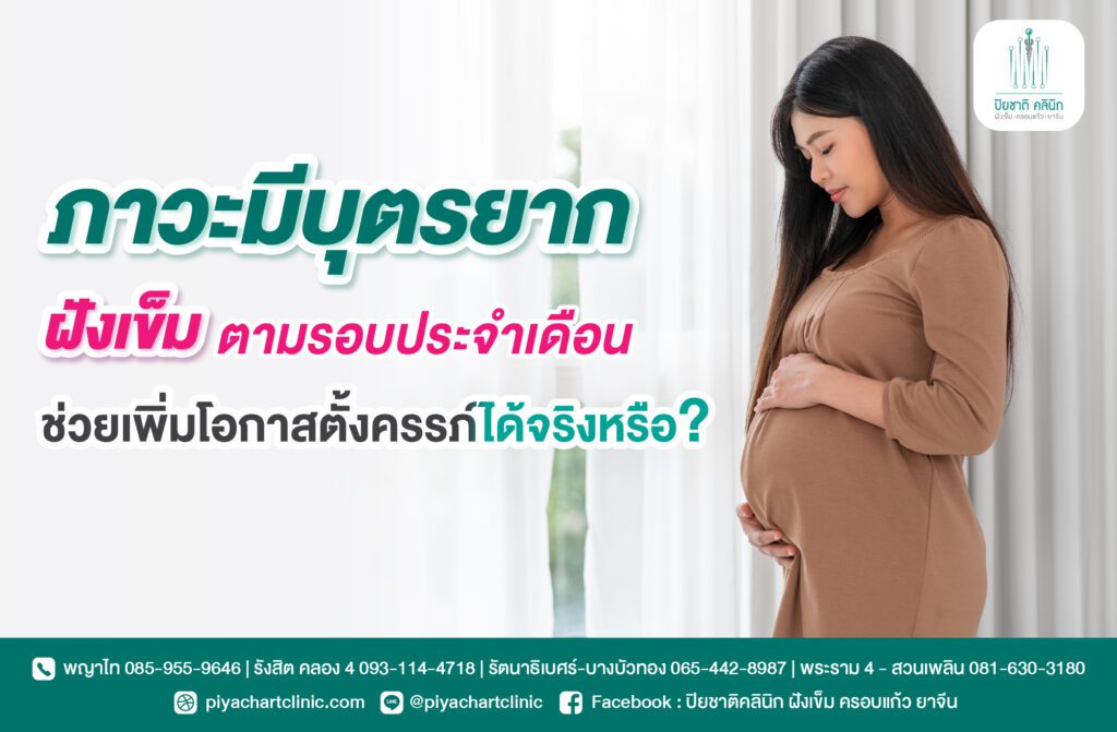 ภาวะมีบุตรยาก ฝังเข็มตามรอบประจำเดือนช่วยเพิ่มโอกาสตั้งครรภ์ได้จริงหรือ?