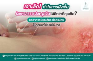 เจาะลึก! ทำไมการฝังเข็มรักษาอาการปวดงูสวัดได้ดีกว่าที่คุณคิด? ลดอาการปวดเสียว ปวดแปลบ ให้กลับมาใช้ชีวิตได้ปกติ