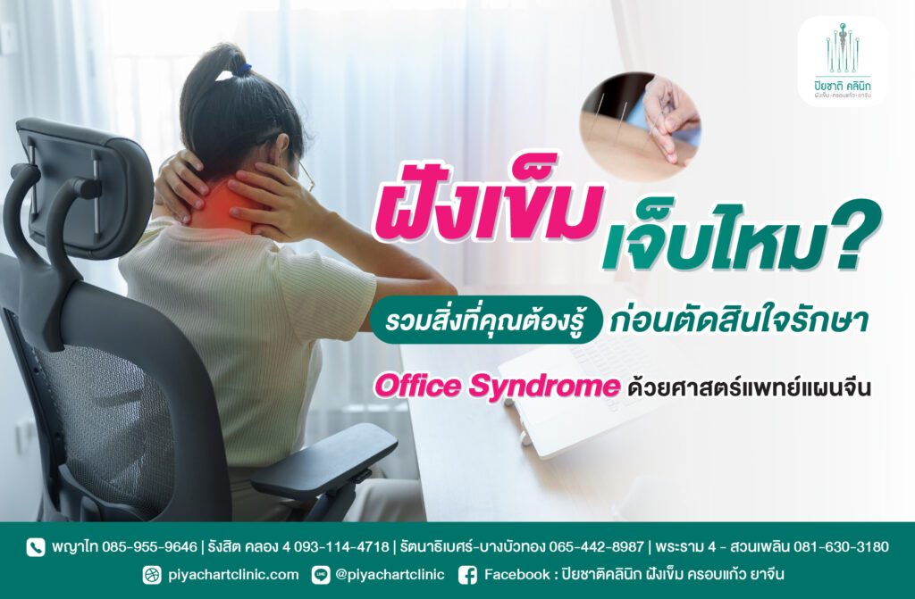 ฝังเข็มเจ็บไหม? รวมสิ่งที่คุณต้องรู้ก่อนตัดสินใจรักษา Office Syndrome ด้วยศาสตร์แพทย์แผนจีน