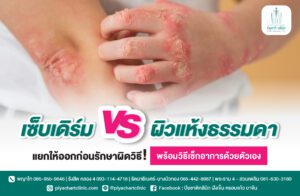 เซ็บเดิร์ม vs ผิวแห้งธรรมดา แยกให้ออกก่อนรักษาผิดวิธี! พร้อมวิธีเช็กอาการด้วยตัวเอง