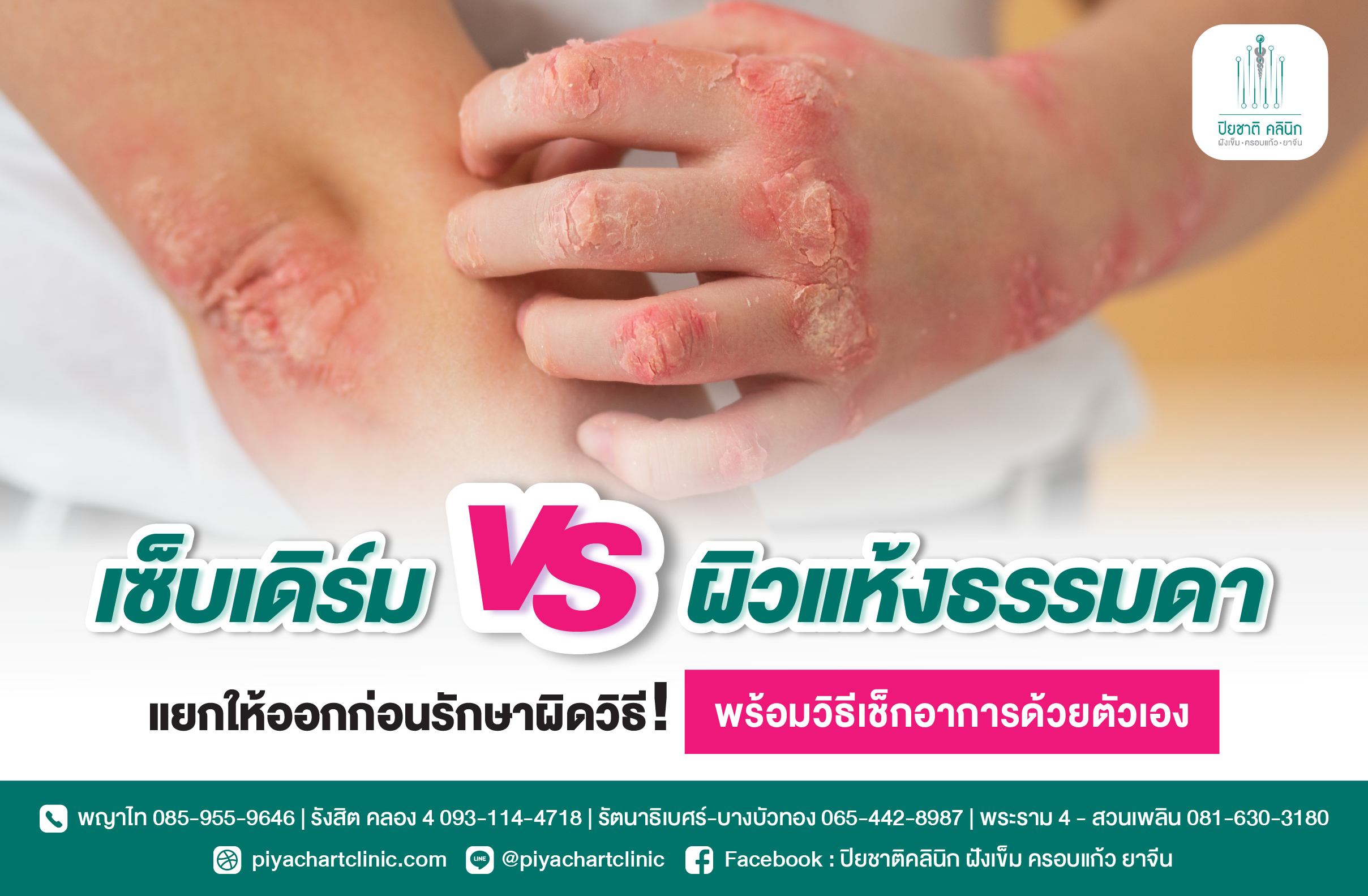 เซ็บเดิร์ม vs ผิวแห้งธรรมดา แยกให้ออกก่อนรักษาผิดวิธี! พร้อมวิธีเช็กอาการด้วยตัวเอง