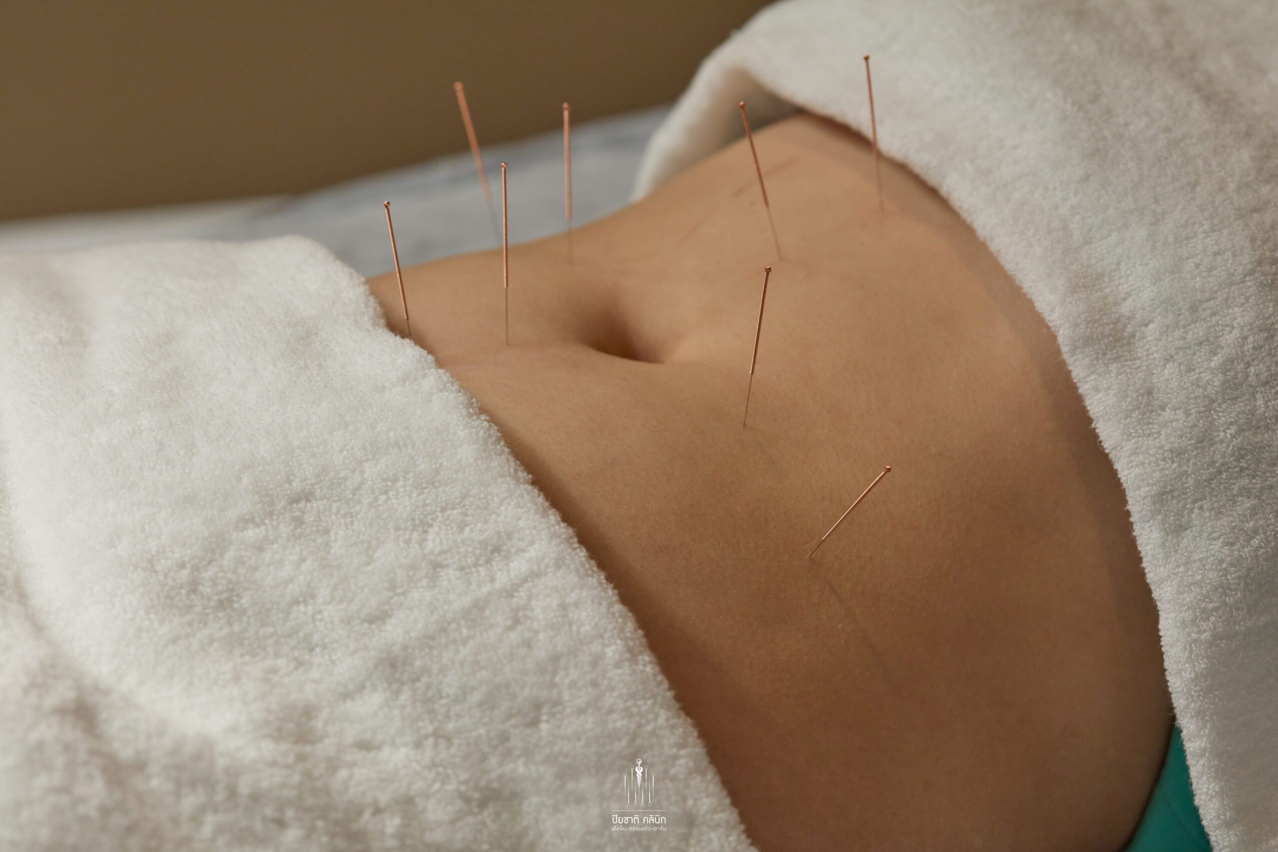 ฝังเข็มลดความอ้วน ที่ Piyachart Clinic มีแพทย์ผู้มีประสบการณ์ในการให้คำปรึกษา ตรวจวินิจฉัย แนะนำ และทำการรักษาอย่างเหมาะสมให้กับคนไข้ รวมถึงติดตามการรักษาและประเมินผลอย่างต่อเนื่องหากท่านใดสนใจเกี่ยวกับฝังเข็มลดน้ำหนัก