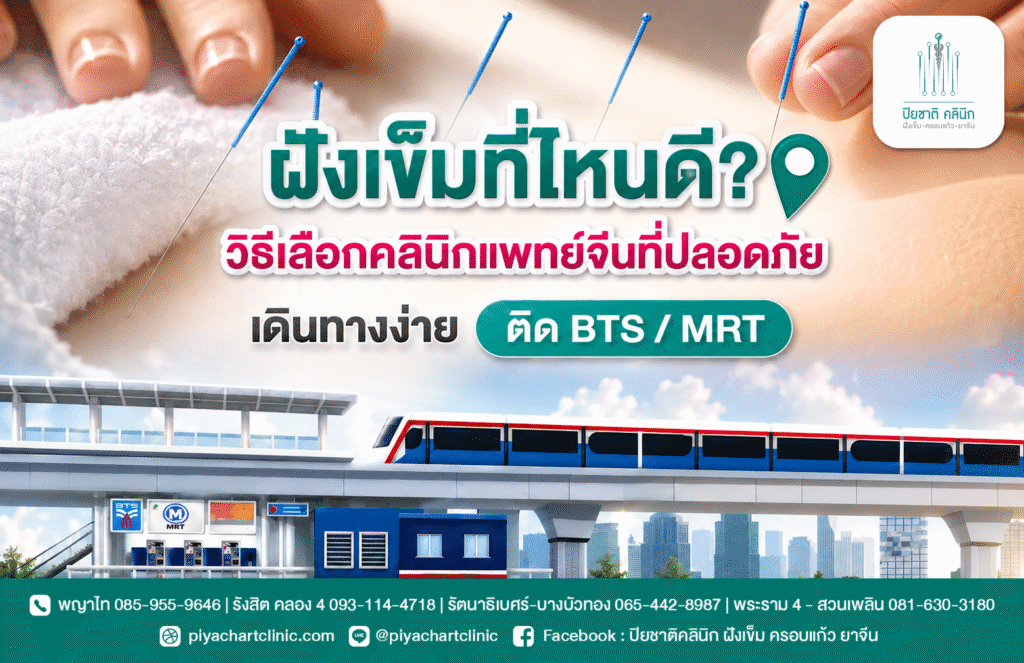 ฝังเข็มที่ไหนดี? วิธีเลือกคลินิกแพทย์จีนที่ปลอดภัย เดินทางง่าย ติด BTS/MRT