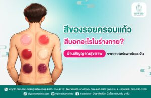 สีของรอยครอบแก้ว บอกอะไรในร่างกาย? อ่านสัญญาณสุขภาพจากศาสตร์แพทย์แผนจีน