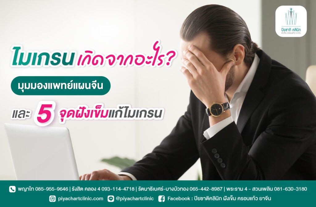 ไมเกรนเกิดจากอะไร? มุมมองแพทย์แผนจีน และ 5 จุดฝังเข็มแก้ไมเกรน