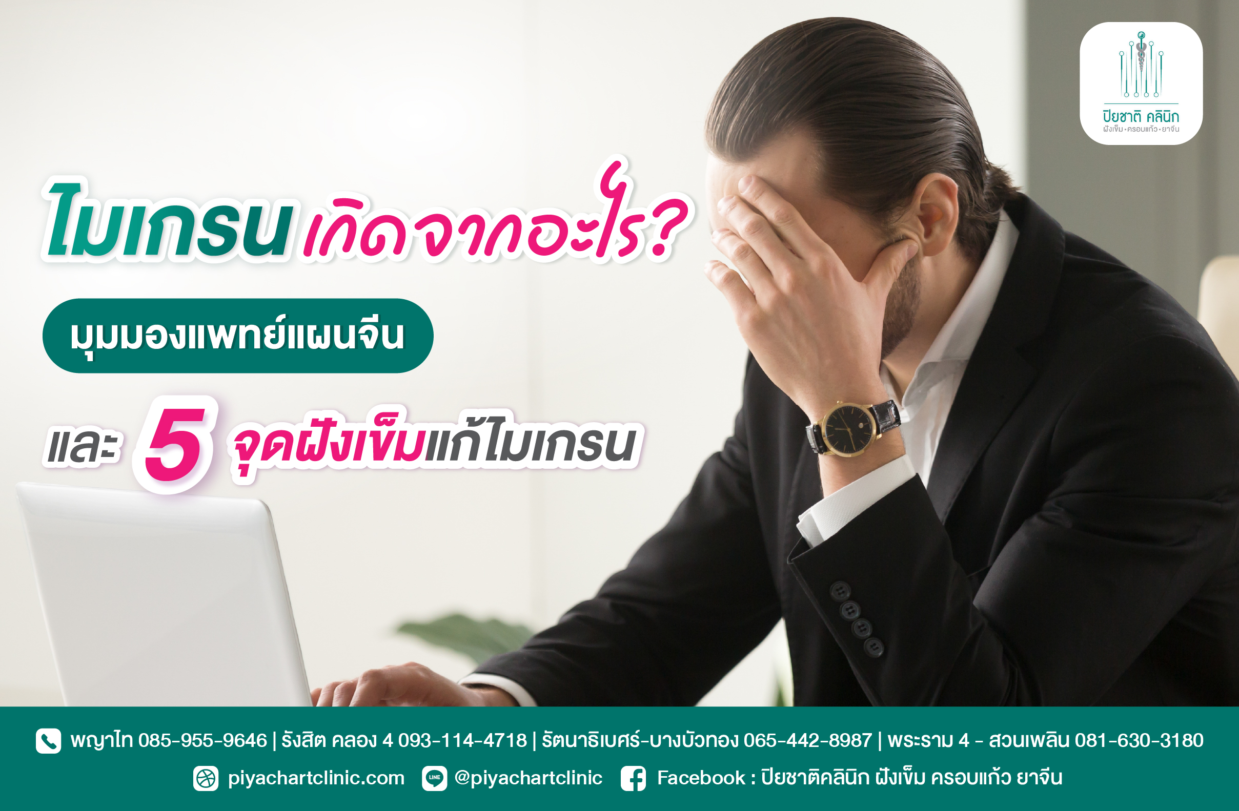 ไมเกรนเกิดจากอะไร? มุมมองแพทย์แผนจีน และ 5 จุดฝังเข็มแก้ไมเกรน