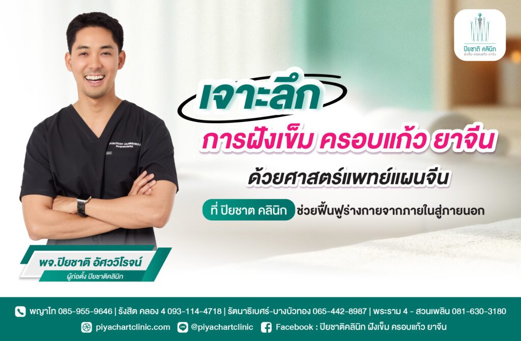 เจาะลึกการฝังเข็ม ครอบแก้ว ยาจีนด้วยศาสตร์แพทย์แผนจีนที่ ปิยชาต คลินิก ที่ช่วยฟื้นฟูร่างกายจากภายในสู่ภายนอก