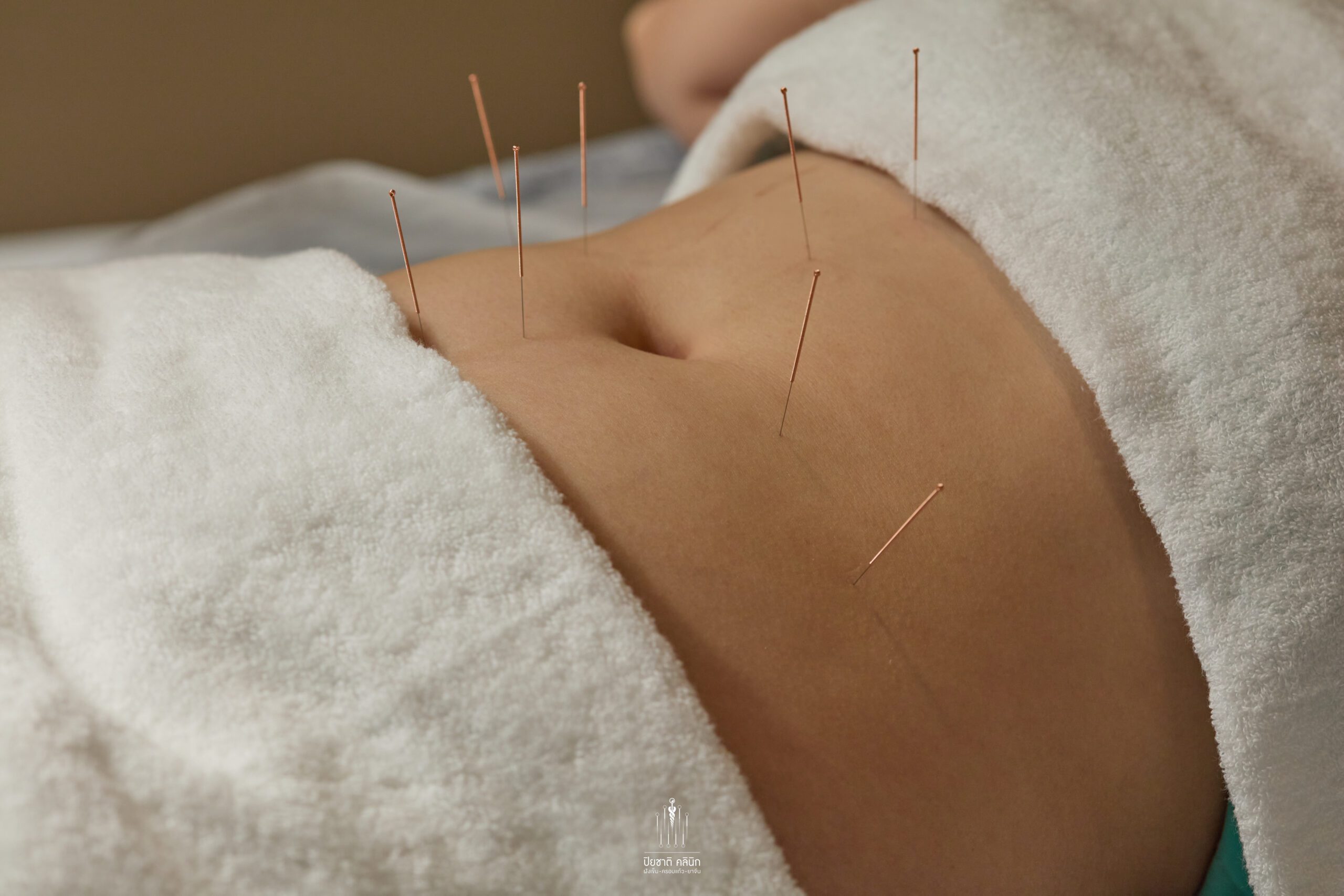 การรักษาภาวะมีบุตรยาก ด้วยศาสตร์การแพทย์แผนจีน การฝังเข็ม (Acupuncture) เป็นวิธีหนึ่งที่ช่วยกระตุ้นการไหลเวียนเลือด การฝังเข็มจะช่วยกระตุ้นระบบต่อมไร้ท่อที่มีหน้าที่ผลิตและปล่อยฮอร์โมนที่มีผลต่อการตกไข่ การมีประจำเดือน และการตั้งครรภ์   ปรับสมดุลระดับฮอร์โมนเช่น เอสโตเจน โปรเจสเตอโรน ฮอร์โมนที่ช่วยกระตุ้นการเจริญเติบโตของฟอลลิเคิล (FSH) และ ฮอร์โมนลูทีไนซิง (LH) ช่วยเพิ่มการไหลเวียนเลือดไปยังบริเวณอวัยวะสืบพันธุ์รังไข่