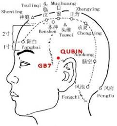 จุดฝังเข็มแก้ไมเกรน ชวี่ปิน (GB7)
เป็นอีกหนึ่งจุดสำคัญบริเวณข้างศีรษะ ใช้ช่วยลดอาการปวดศีรษะจากลมและความตึงของเส้นลมปราณ เหมาะสำหรับผู้ที่มีอาการปวดร้าวจากต้นคอขึ้นศีรษะ หรือปวดหลังโดนลมเย็นและอากาศเปลี่ยน