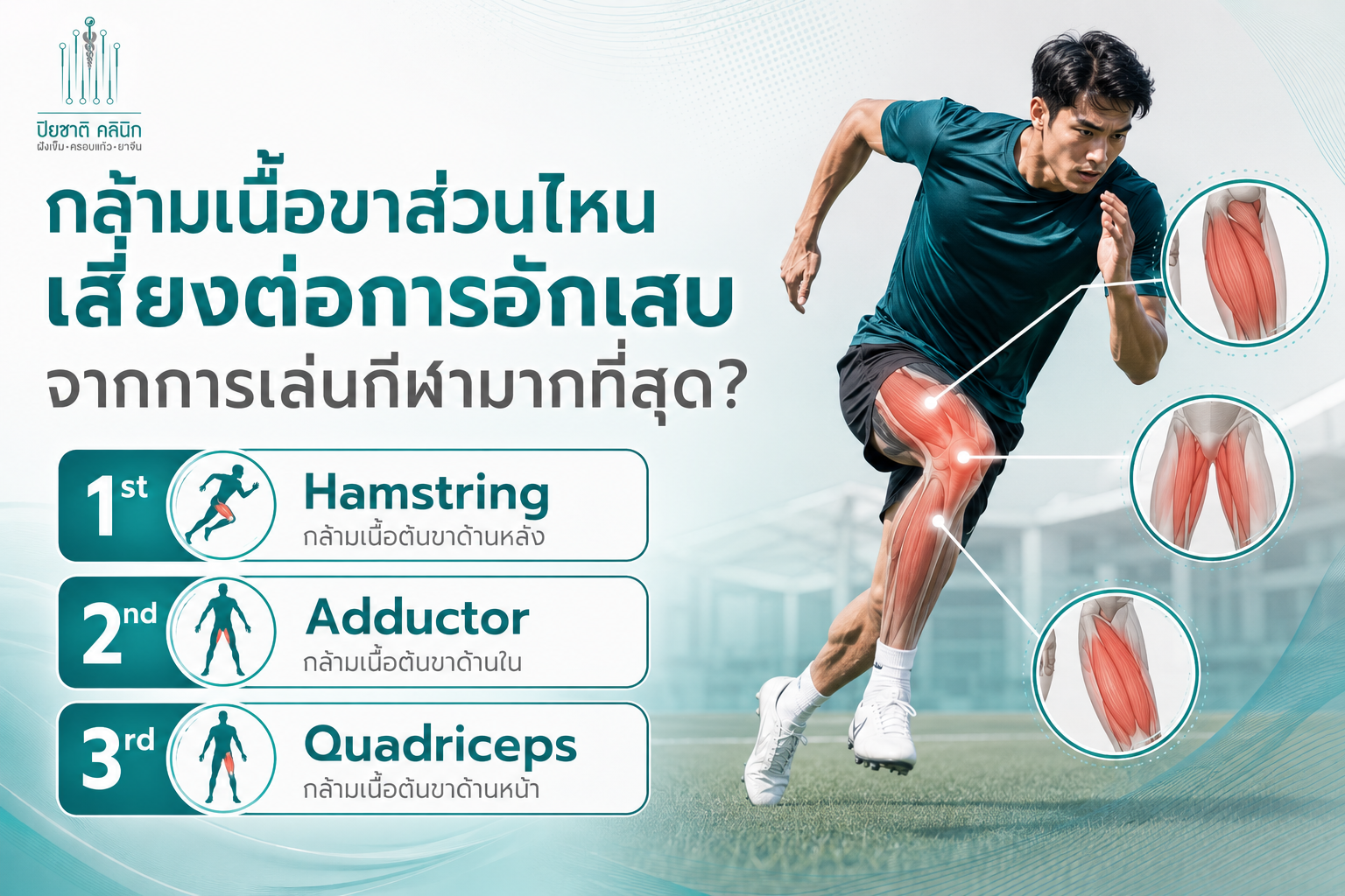 กล้ามเนื้อขาอักเสบ จากงานวิจัย Hamstring เป็นกล้ามเนื้อขาที่มีความเสี่ยงต่อการบาดเจ็บและการอักเสบจากการเล่นกีฬามากที่สุด รองลงมาคือ Adductor และ Quadriceps