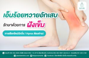 เอ็นร้อยหวายอักเสบ รักษาด้วยการฝังเข็ม ทางเลือกใหม่นักวิ่ง / Hyrox ต้องอ่าน!