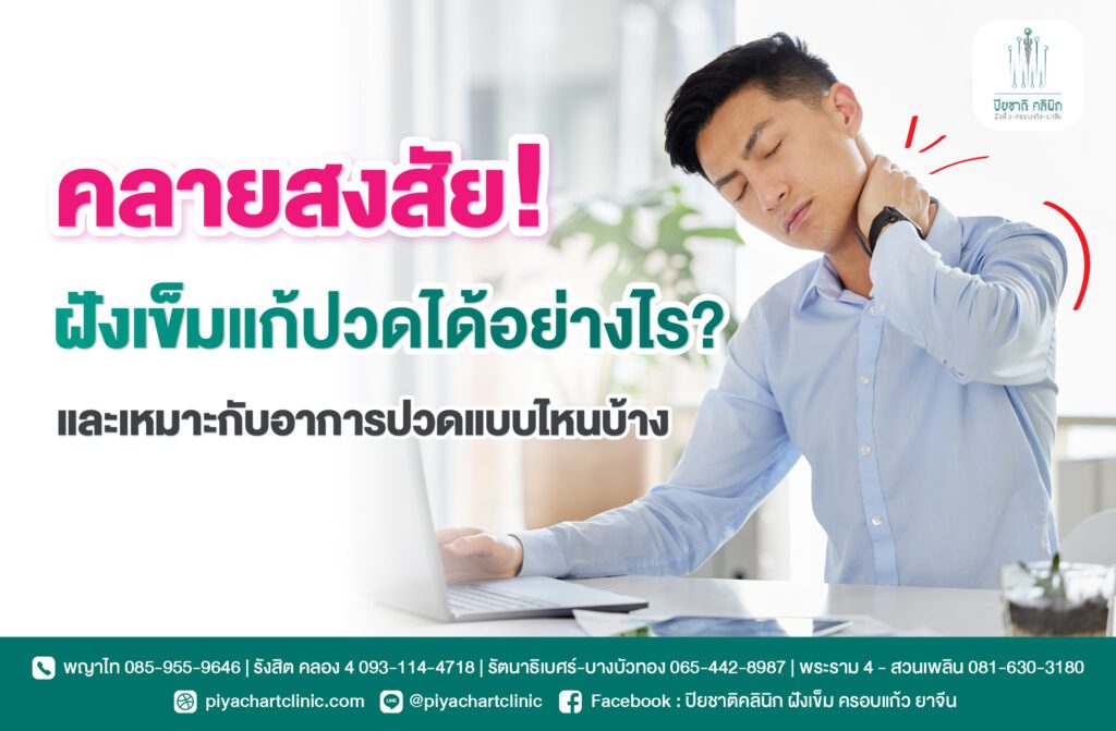 คลายสงสัย! ฝังเข็มแก้ปวดได้อย่างไร? และเหมาะกับอาการปวดแบบไหนบ้าง